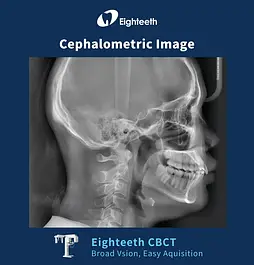 Комп'ютерні Томографи