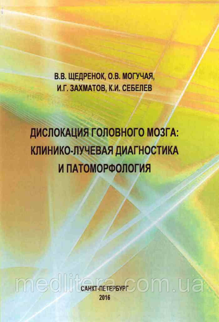 Щедренок, Могутня, Захматов, Себелев Дислокація головного мозку: клініко-променева діагностика та патоморфологія