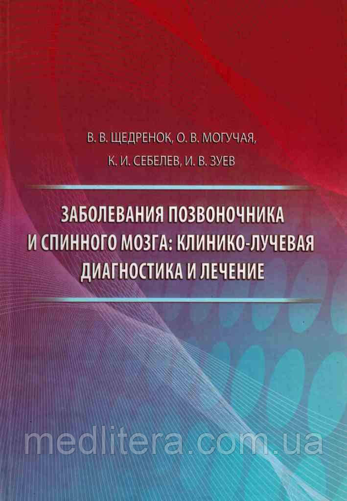 Щедренок, Могутня, Себелев, Захворювання хребта і спинного мозку: клініко-променева діагностика та лікування