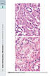 Книга «Wheater's Basic Pathology: A Text, Atlas, and Review of Histopathology. International Edition, 5th Edition». Автор - Вільям, фото 9
