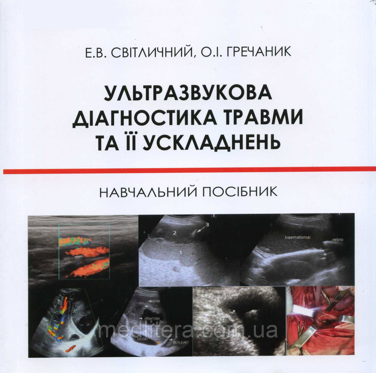 Світличний Е. В., Гречаник О. І. Ультразвукова діагностика травми та її ускладнень