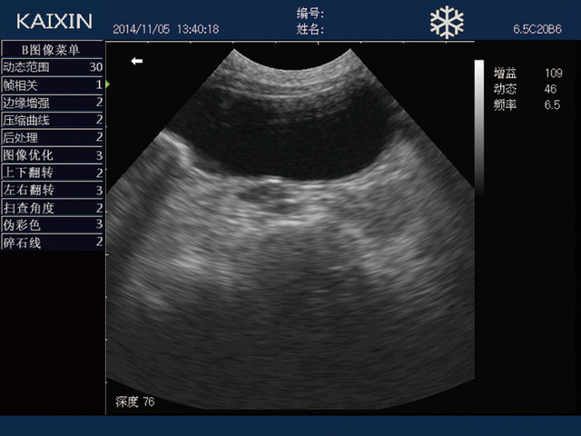 Ультразвуковой ветеринарный сканер KX5600