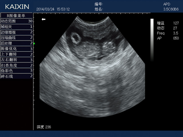 Ультразвуковой ветеринарный сканер KX5600