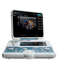 Esaote MyLab Gamma Portable Ultrasound System - Апарат УЗД Система для багатоцільового використання