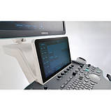 Стаціонарний УЗД апарат експертного класу Resona 7, фото 5