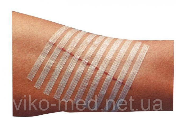Пластырний шкірний шов 3М Стері-Стріп (Steri - Strip) 6 x 100 мм №10 ...
