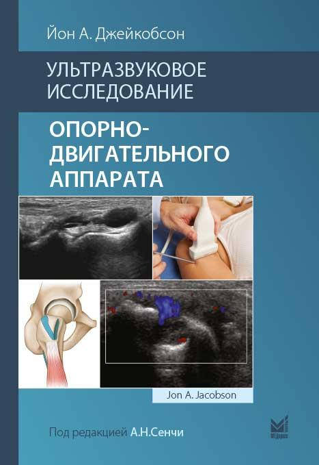 

Йон А. Джейкобсон. Ультразвуковое исследование опорно-двигательного аппарата