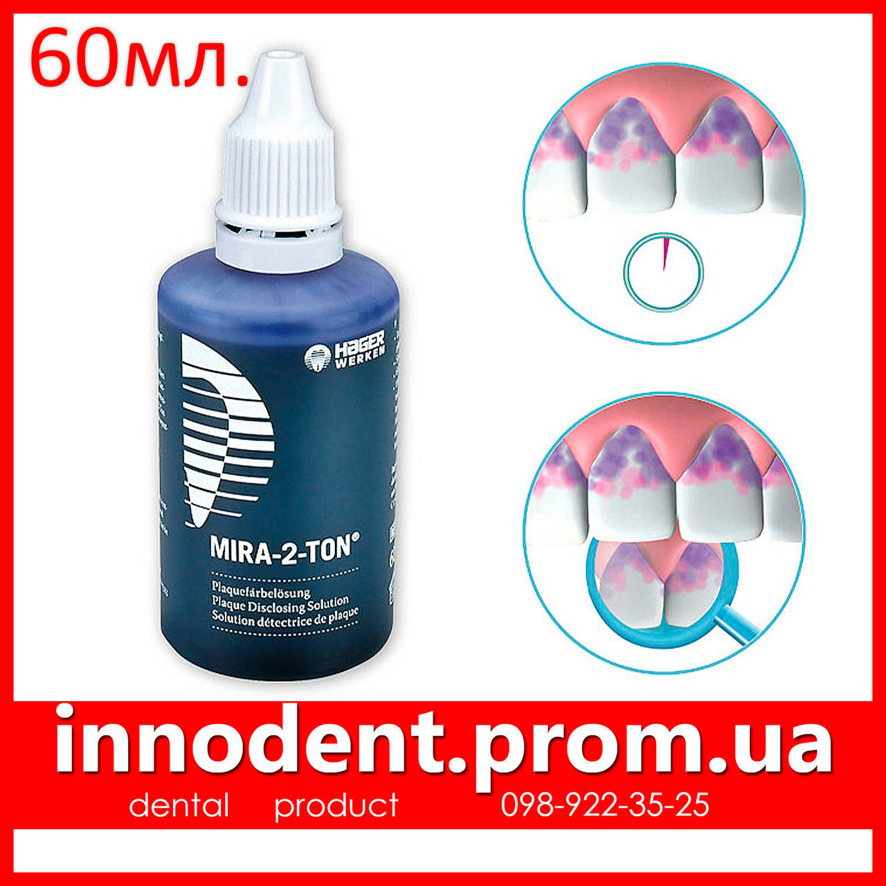 

Mira-2-Ton Индикатор зубного налета, 60 мл (Miradent)