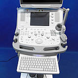 Апарат УЗД для ультразвукової діагностики Toshiba Aplio MX Ultrasound Machine, фото 4