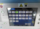 Апарат УЗД для ультразвукової діагностики Toshiba Aplio MX Ultrasound Machine, фото 8