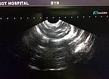 Ультразвуковий датчик Зонд Toshiba PVM-661VT Endovaginal Transducer, фото 7