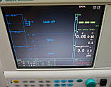 Наркозний Апарат для Анестезіології GE Datex Ohmeda Aestiva 5 Anesthesia Machine + 7900 SmartVe, фото 4