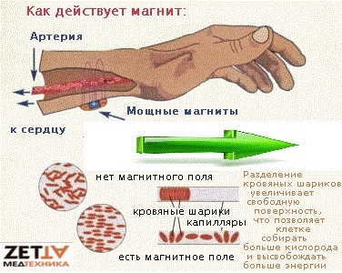 браслет магнитный с магнитами купить в днепре