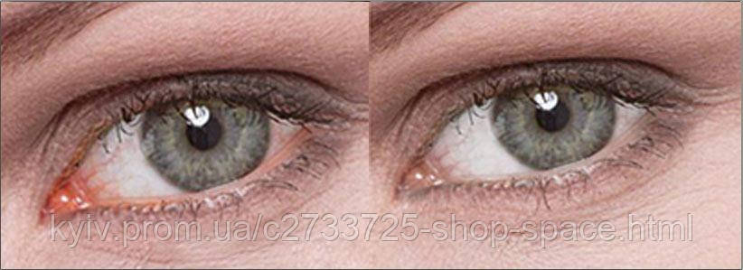 Купити Iridina Due відбілюючі краплі для очей (Італія). Иридина, ціна ...