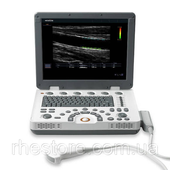 УЗД апарат Samsung Medison MySono U6, фото 1