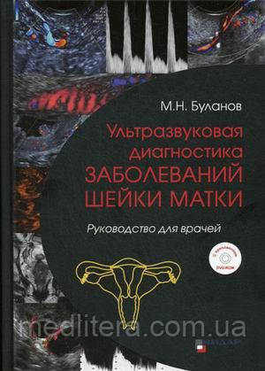 Буланов М. Н Ультразвукова діагностика захворювань шийки матки. Керівництво для лікарів + DVD