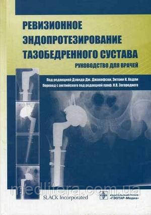 Джакофски Дж., Хедлі Е. К. Ревізійне ендопротезування кульшового суглоба. Керівництво для лікарів.