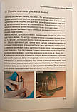 Книга з гірудотерапії «Натуропатична медицина Гірудотерапія та фізіологія здоров'я» Л Куплівська, фото 3