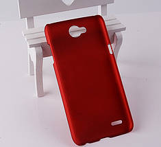 Чохол накладка бампер Alisa для LG X power 2 (4 кольори), фото 2