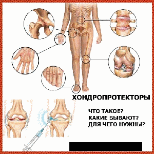 Хондропротектори, суглоби і зв'язки