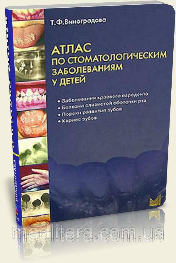 Виноградова Т.Ф. АТЛАС за стоматологічними захворюваннями в дітей