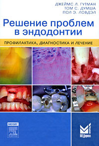 Джеймс Л. Гутман Ловдэл Решение проблем в эндодонтии. Профилактика, диагностика и лечение - фото 1 - id-p40045938