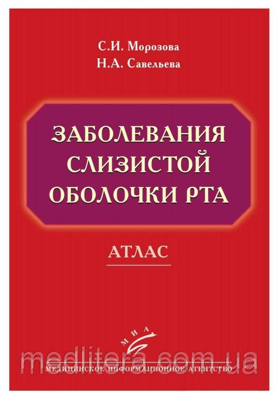 Морозова С. В., Савельєва Н.А. Захворювання слизової оболонки рота. Атлас