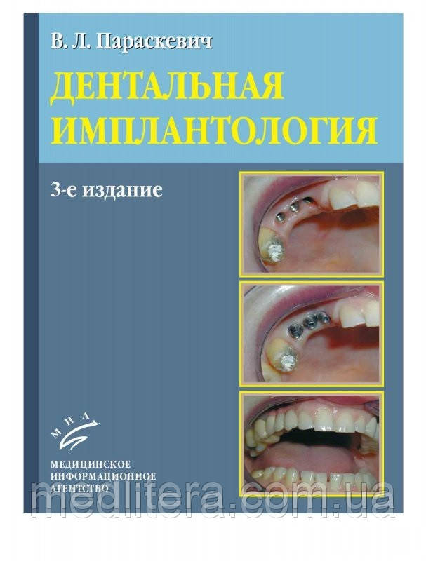 Параскевич В. Л. Дентальная имплантология 3-е изд - фото 1 - id-p40065075