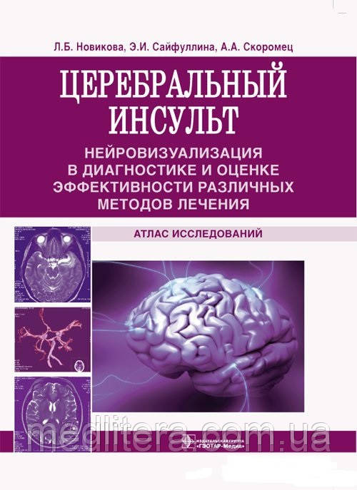 Новикова Л.Б., Сайфуллина Э.И., Скоромец А.А. Церебральный инсульт - фото 1 - id-p40372029