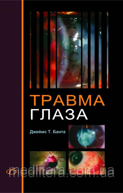 Банта Джеймс Т. Травма ока Практичне керівництво