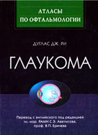Дуглас Дж. Рі, Аветисова, В. Єрічева Глаукома. АТЛАС Більше 400 ілюстрацій