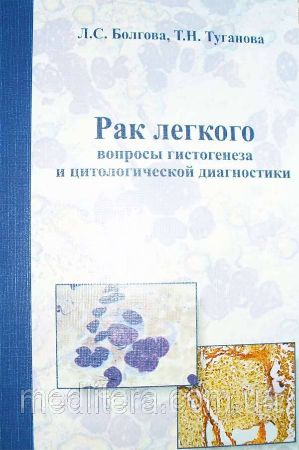 Болгова Л. С. Рак легені: питання гістогенезу та цитологічної діагностики