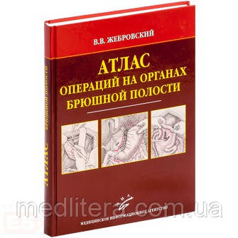 Жебровський В. В Атлас операцій на органах черевної порожнини