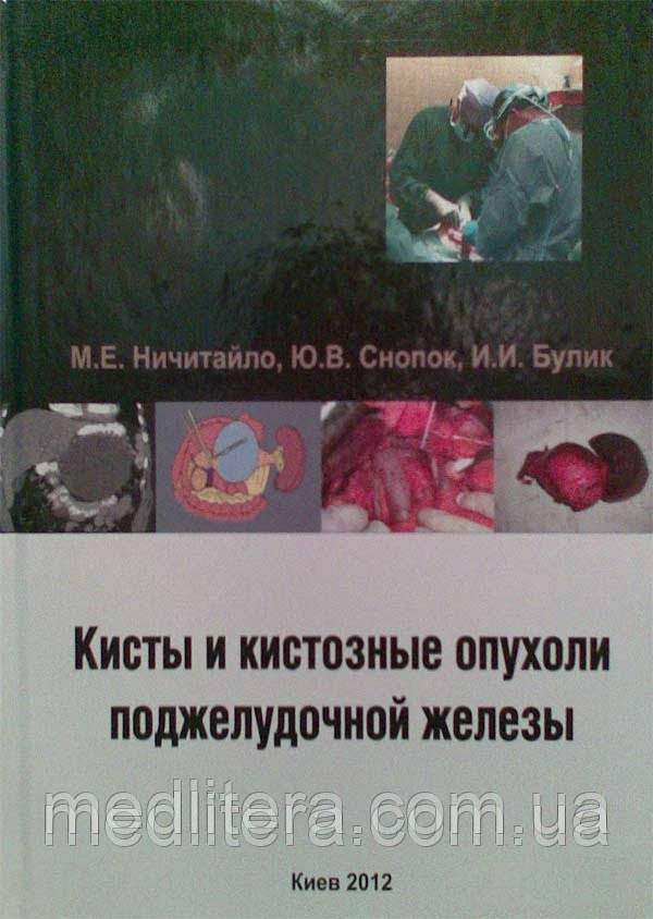 Нечитайло М. Кісти і кістозні пухлини підшлункової залози