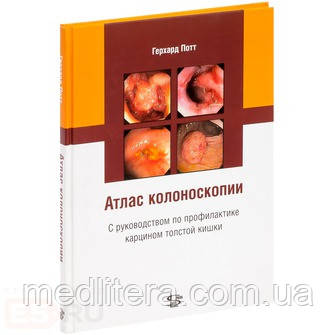 Потт Р. Атлас колоноскопії з керівництвом по профілактиці карцином товстої кишки