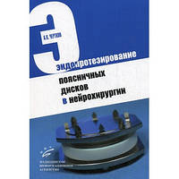 Чертков А.К. Эндопротезирование поясничных дисков в нейрохирургии