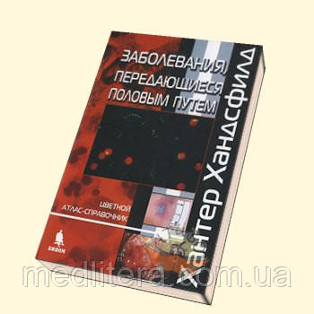 Хансфилд Х. Захворювання, що передаються статевим шляхом