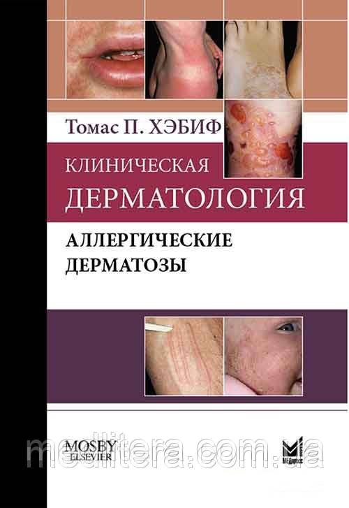 Хебіф Т.П. Клінічна дерматологія. Алергічні дерматози