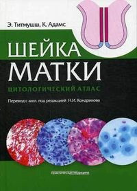 Титмушш Е., Адамс К. Шийка матки. Цитологічний атлас