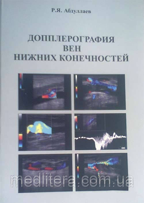 Абдуллаєв Р. Я Доплерографія вен нижніх кінцівок