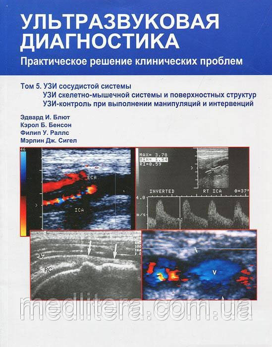 Едвард В. Блют Ультразвукова діагностика. Т. 5 УЗД судинної системи, УЗД скелетно-м'язової системи