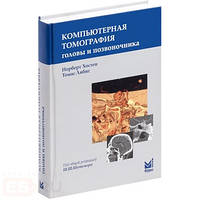 Хостен Н. Комп'ютерна томографія голови і хребта