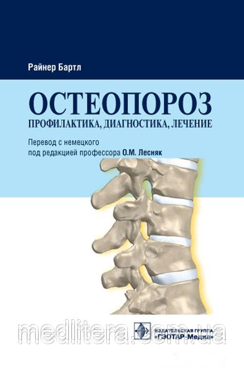 Бартл Р. Остеопороз. Профілактика, діагностика, лікування