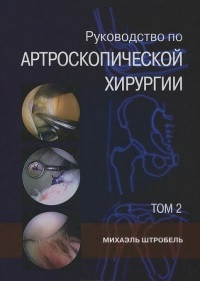 Міхаель Штробель. Керівництво по артроскопічної хірургії. Том 2