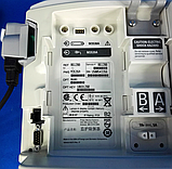 Б/У Дефібрилятор/монітор Philips HeartStart MRx Defibrillator (Used), фото 4