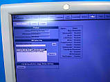 Апарат УЗД для ультразвукової діагностики USG GE Logiq P5 Ultrasonograf, фото 7