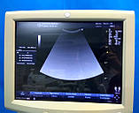 Апарат УЗД для ультразвукової діагностики USG GE Logiq A5 Ultrasonograf, фото 5