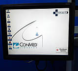 Стійка обладнання для Лапароскопії та Артроскопії ConMed IM4000 Arthro-Laparoscopic Tower, фото 7