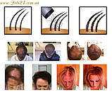 Пудра-загусник волосся Sevich 10 кольорів для об'єму камуфляж лисини, як-от Toppik Fully Caboki Med Blond, фото 2