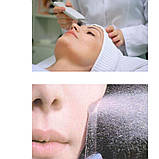Апарат для ультразвукового чищення обличчя Bio sonic 800/bon990 + 2 апаратні гелі, фото 6